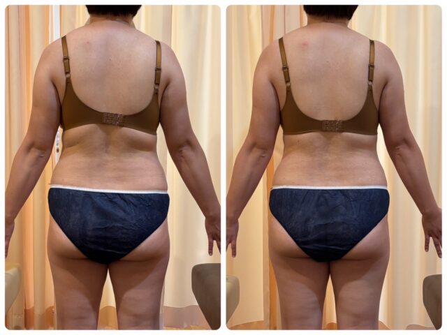 何しても痩せませんでした